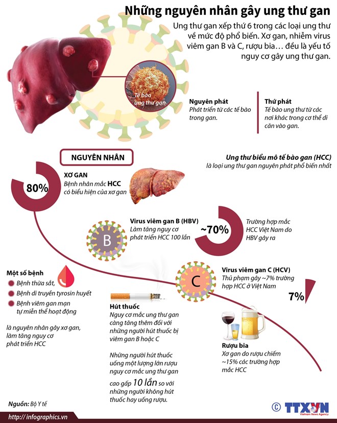 [Infographics] Tìm hiểu những nguyên nhân gây ung thư gan