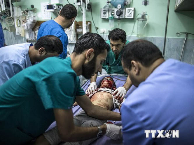 Một bé gái Palestine bị thương trong cuộc không kích của Israel điều trị tại bệnh viện ở Beit Lahia, phía bắc Dải Gaza ngày 22-7. (Nguồn: AFP/TTXVN)