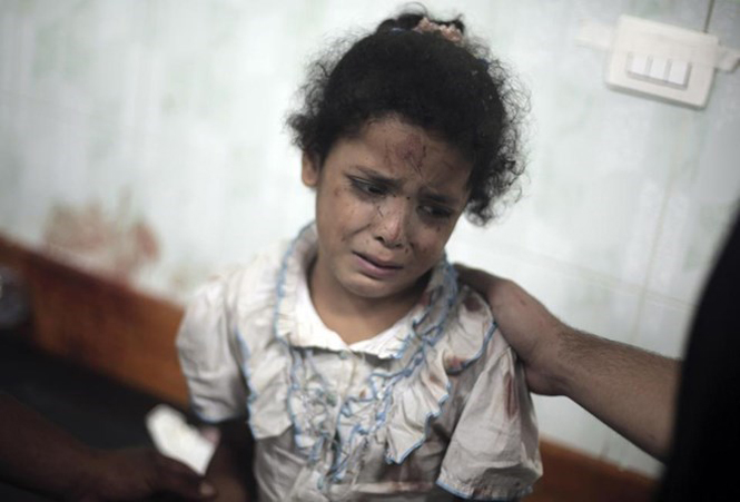 Bé gái bị thương sau đợt pháo kích của Israel vào trường học ở Dải Gaza (Nguồn: AP)