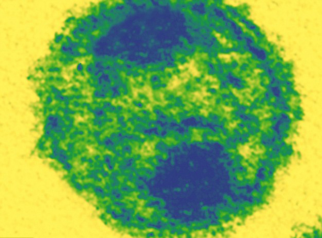  Virus HIV.