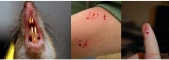 Chuột cắn lây truyền bệnh sốt Sodoku.