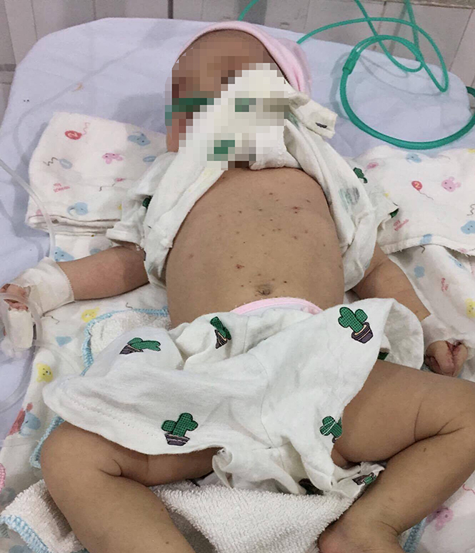 Nhiều trẻ sơ sinh được đưa vào Bệnh viện đa khoa khu vực Bắc Quảng Bình cấp cứu trong tình trạng mất máu nặng vì chích lể.