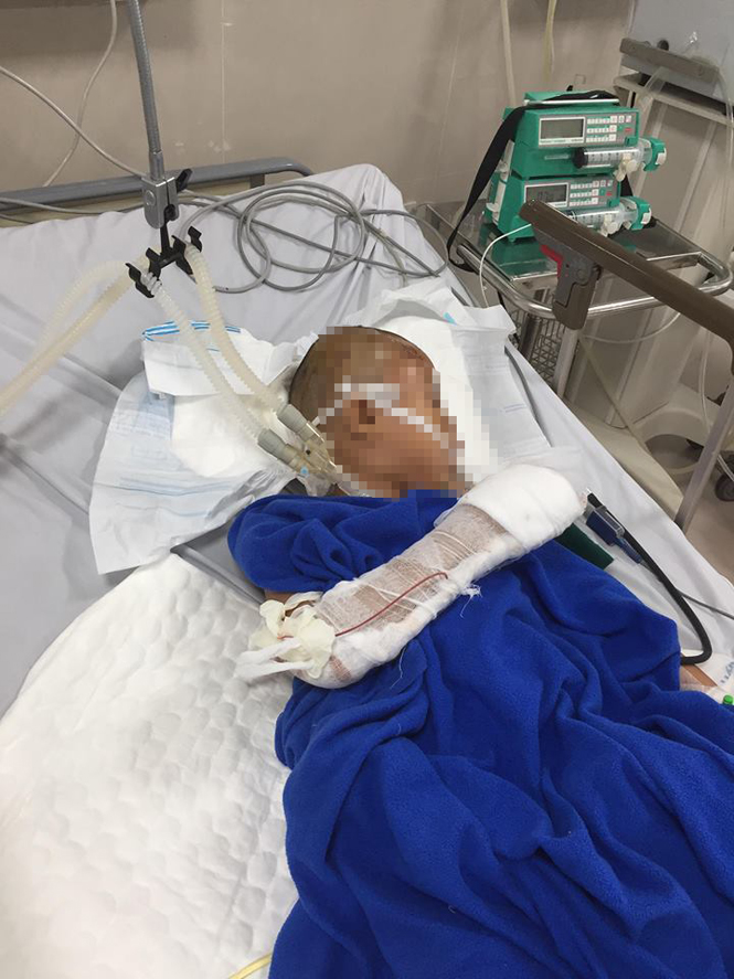 Bé trai 9 tuổi đang được điều trị tại Bệnh viện Hữu nghị Việt Nam- CuBa- Đồng Hới. Ảnh: T.A.D.
