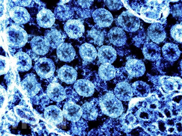 Phát hiện mới về khả năng lây lan của virus SARS-CoV-2