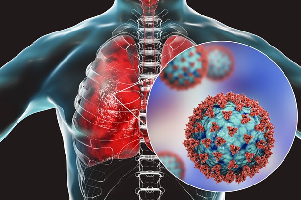 Virus SARS-CoV-2 có khả năng đẩy nhanh tốc độ lão hóa của phổi