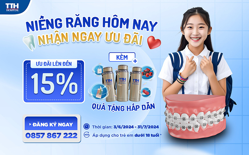 "Niềng răng hôm nay-Nhận ngay ưu đãi"
